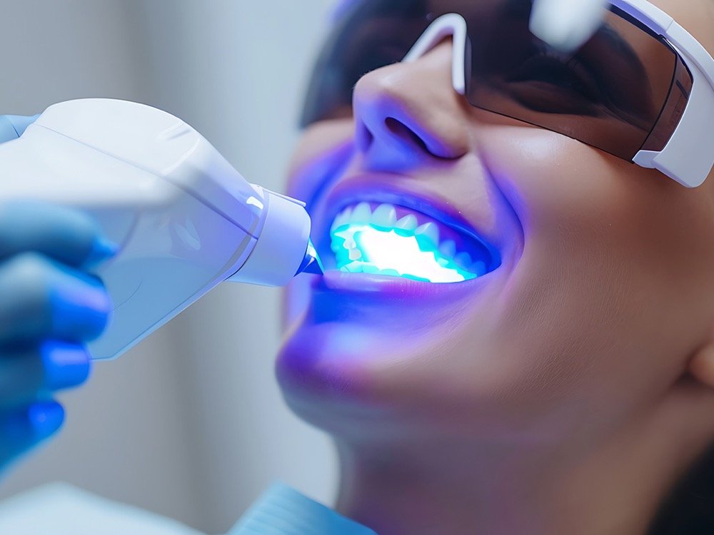 Diş Beyazlatma